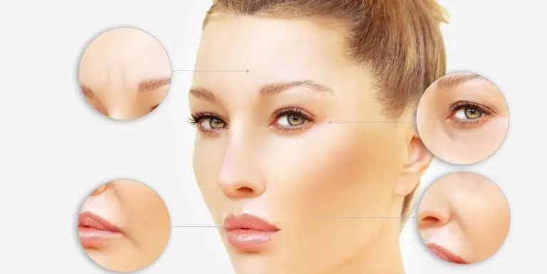 Nadelloses Fadenlifting